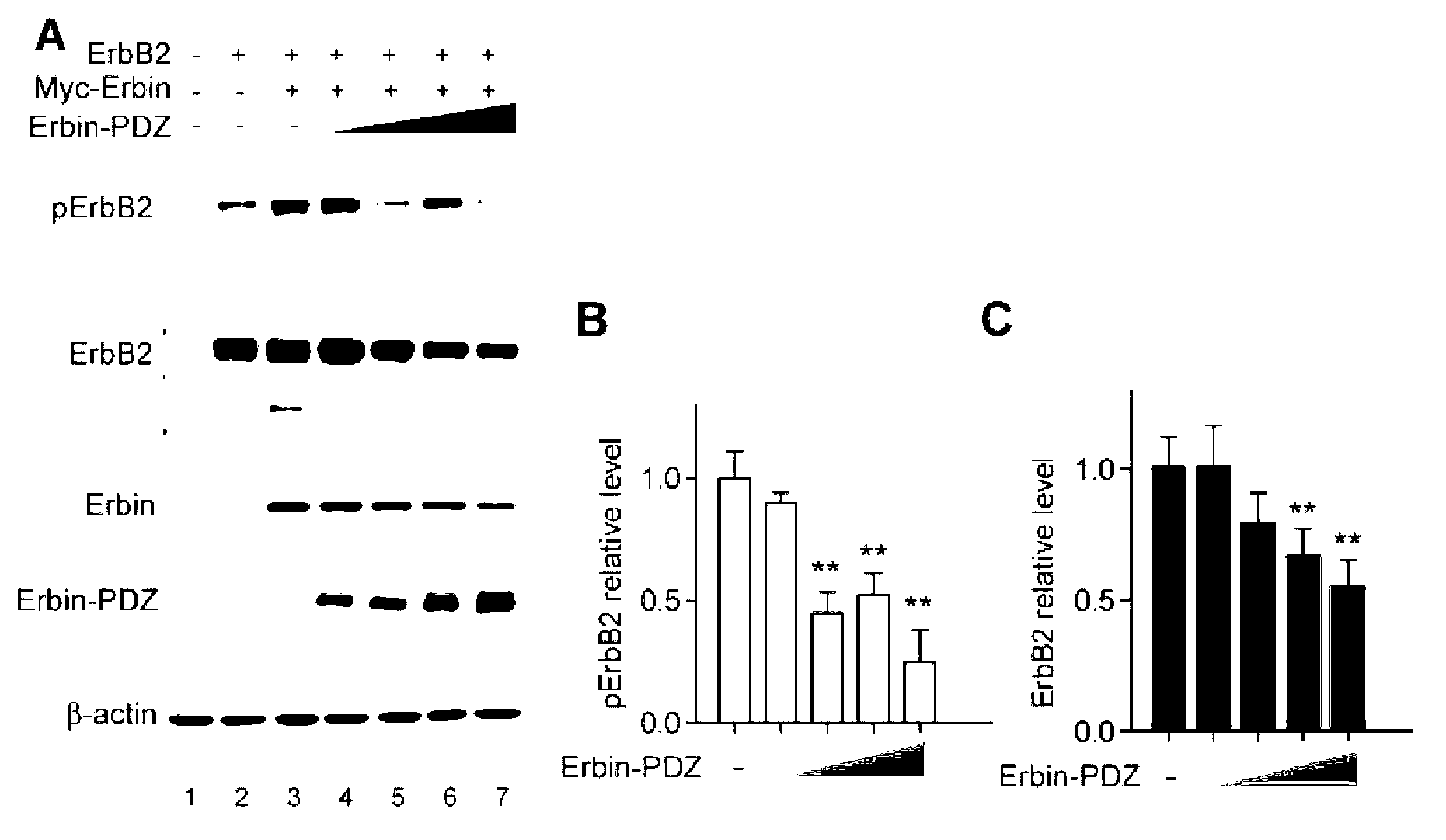 Application of Erbin inhibitor in preparation of antitumor drug