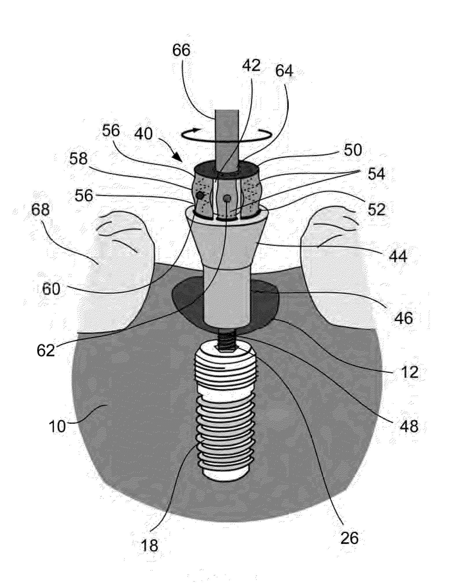 Dental prostheses devices and methods