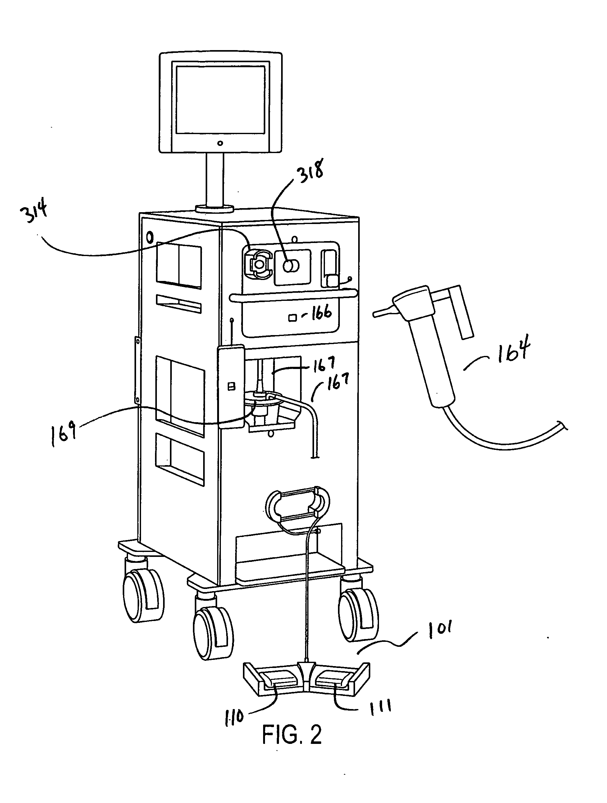 Cryosurgery system