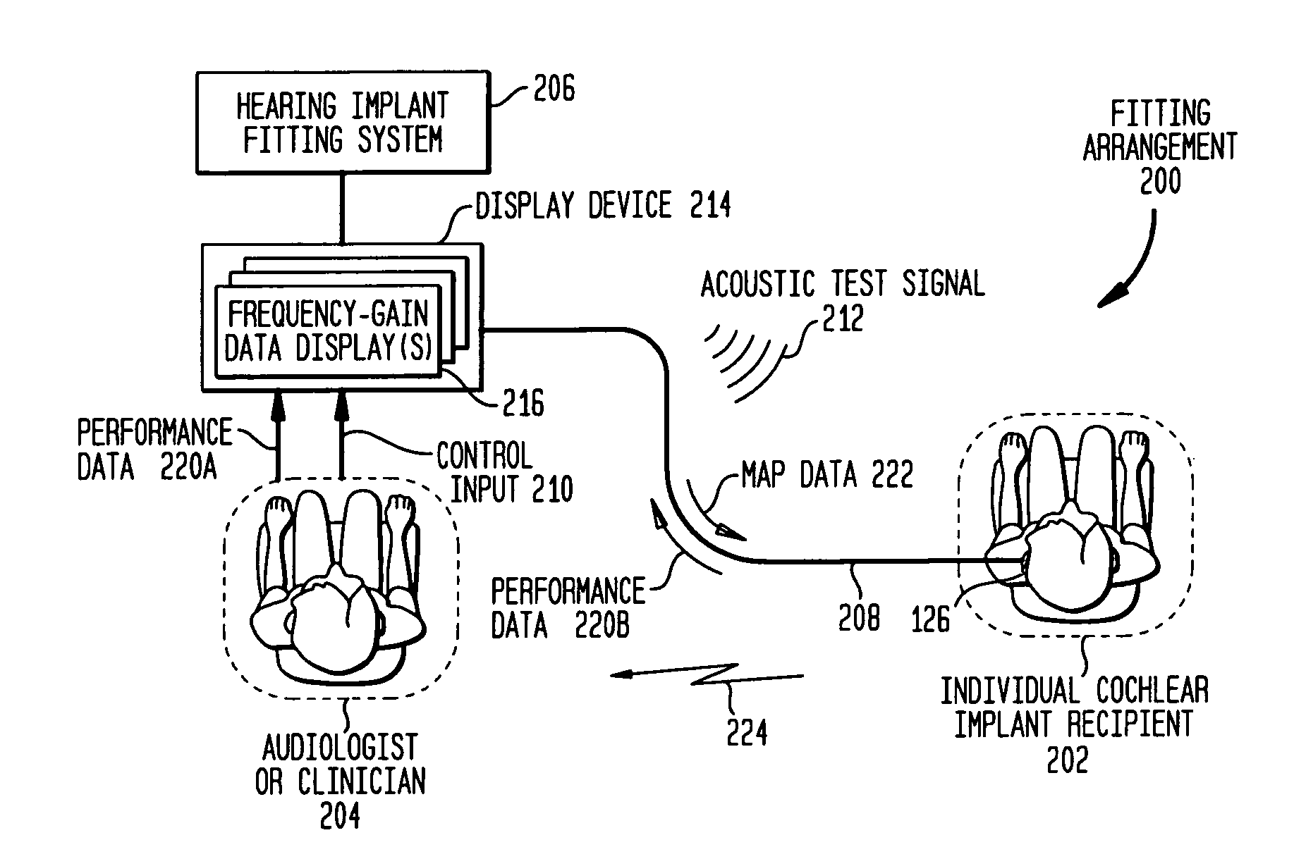 Prosthetic hearing implant fitting technique