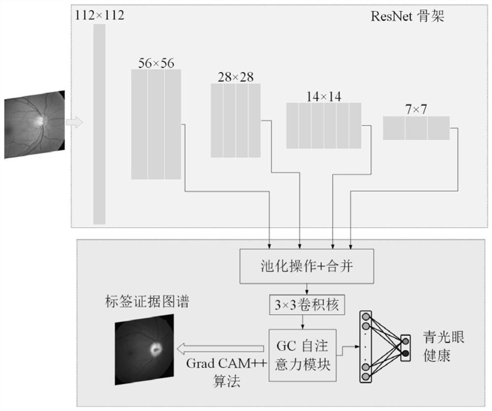 Eye fundus image classification method and device based on multi-task curriculum type learning, equipment and medium