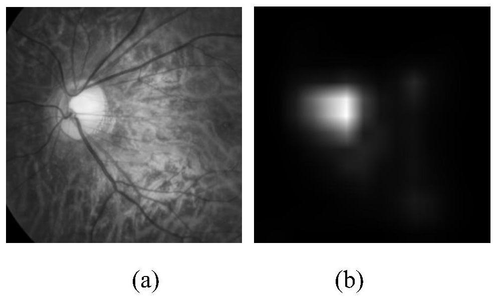 Eye fundus image classification method and device based on multi-task curriculum type learning, equipment and medium