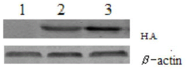 Application of dermastin a in the preparation of preparations for suppressing immune rejection of organ transplantation