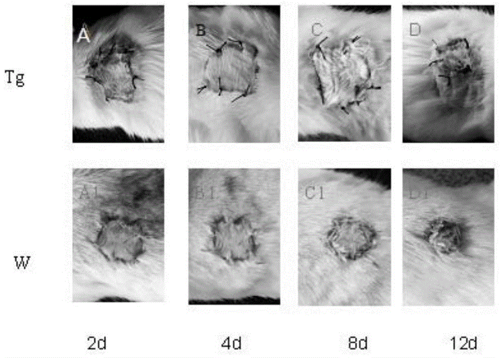 Application of dermastin a in the preparation of preparations for suppressing immune rejection of organ transplantation