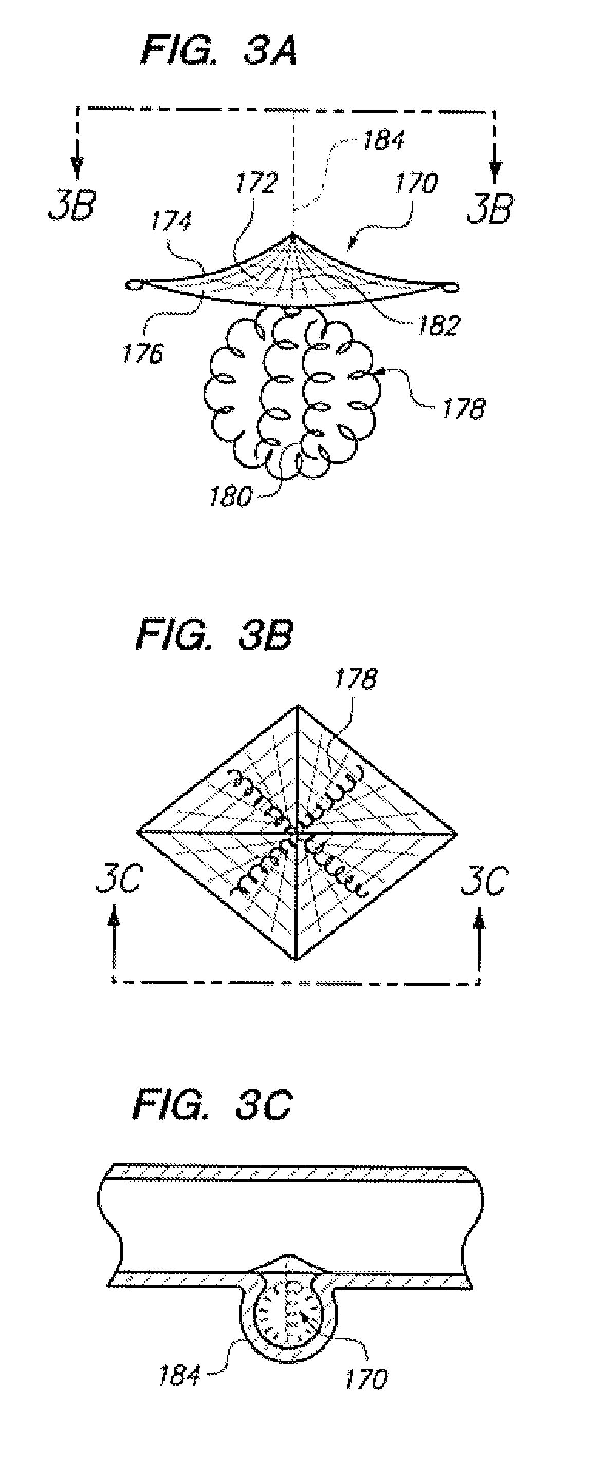 Detachable aneurysm neck closure patch