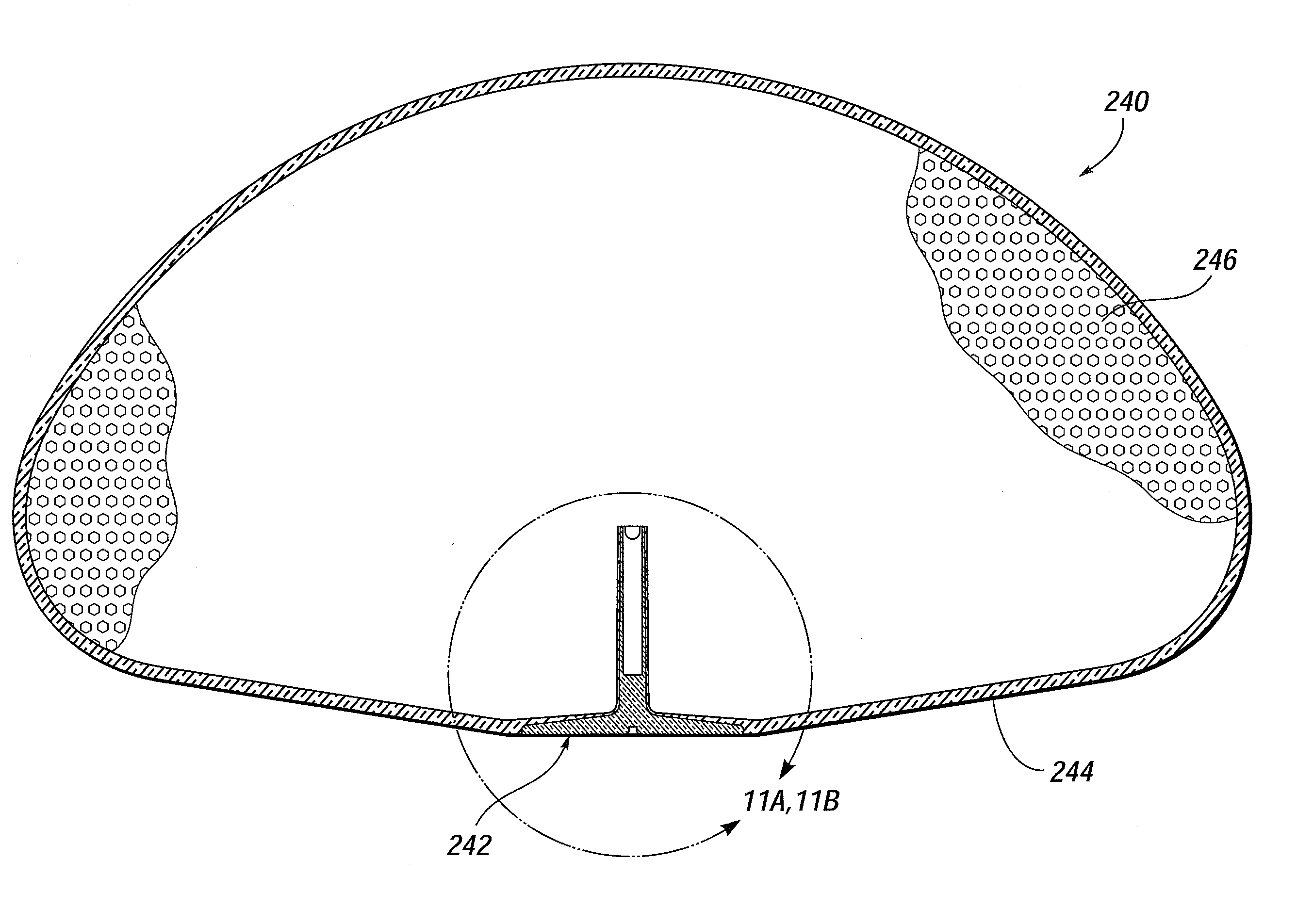 Flush patch for elastomeric implant shell