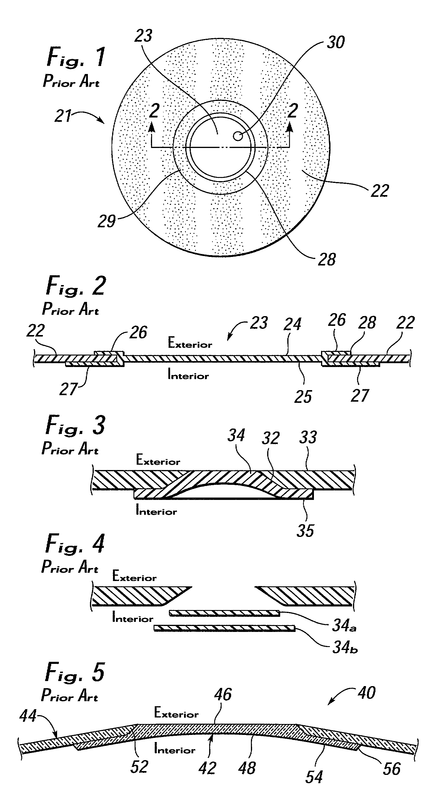 Flush patch for elastomeric implant shell