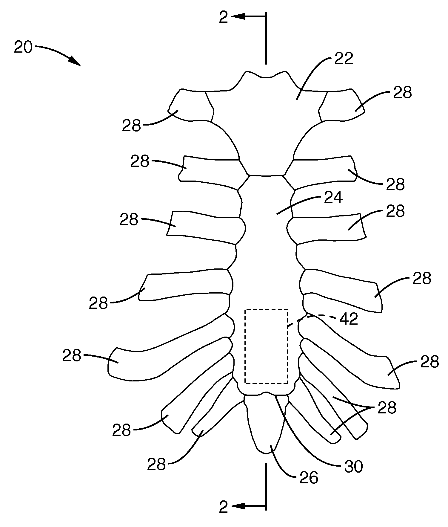 Apparatus and methods for magnetic alteration of anatomical features