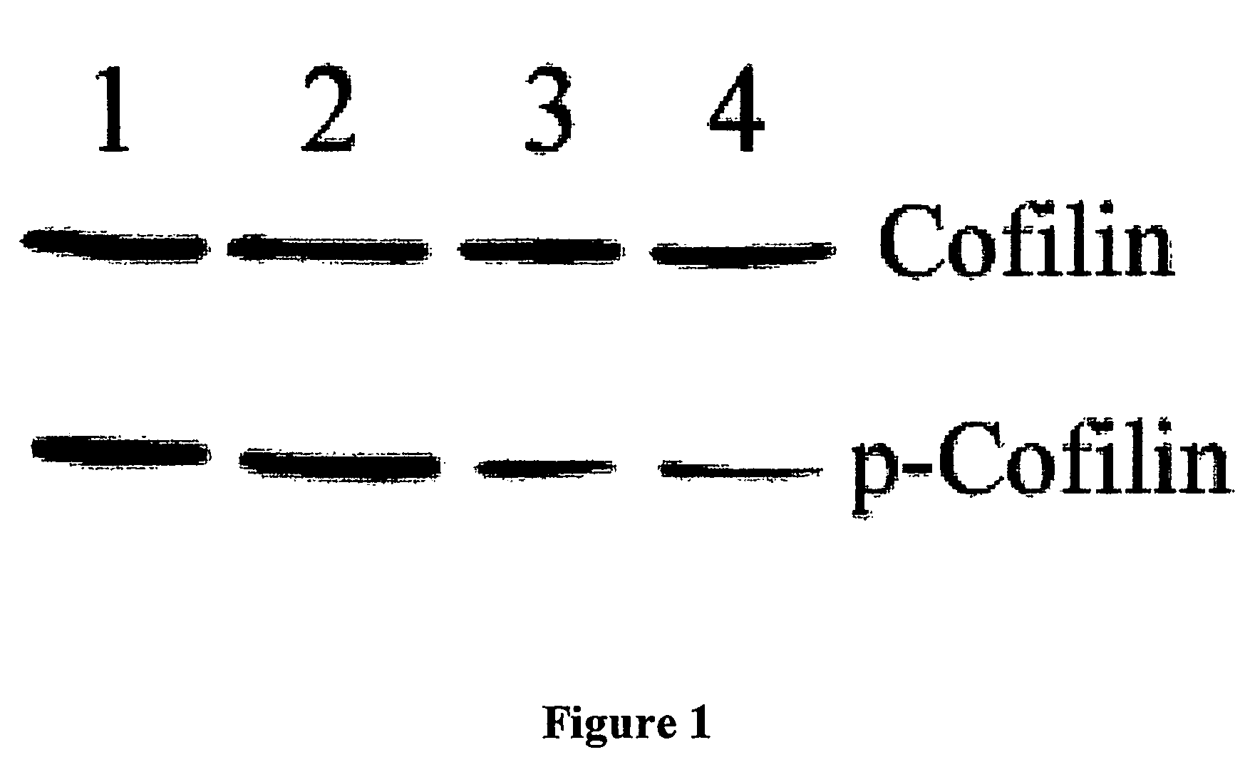 Heat shock protein 20-related polypeptides and uses therefor