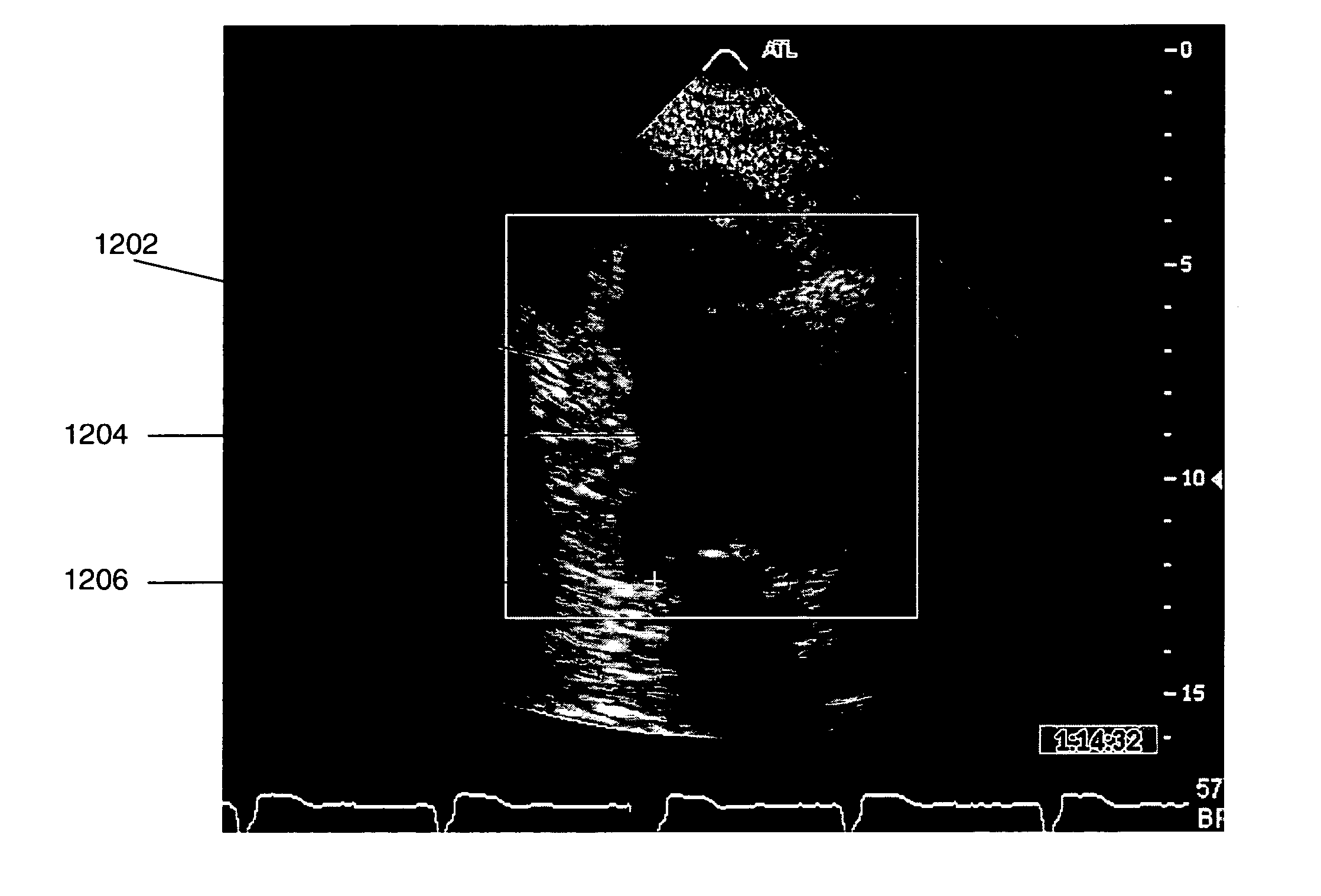 Probabilistic boosting tree framework for learning discriminative models