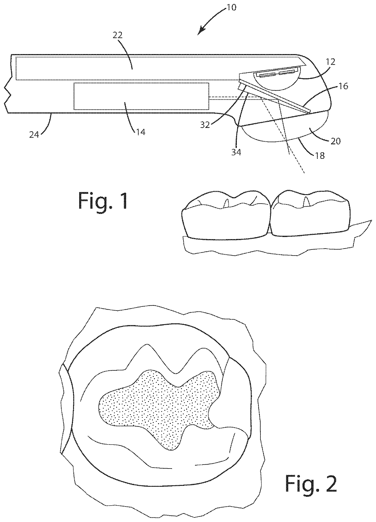 Dental curing light and method