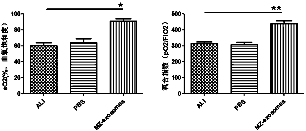 Application of exosome from endometrium stem cells to medicines for treating acute lung injury
