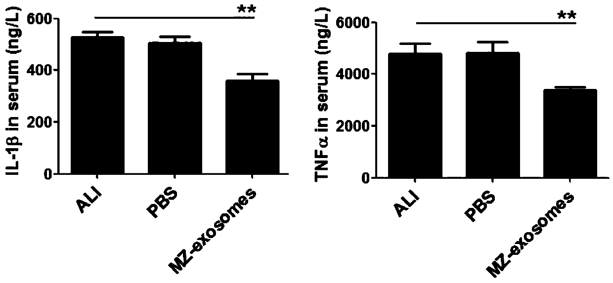 Application of exosome from endometrium stem cells to medicines for treating acute lung injury