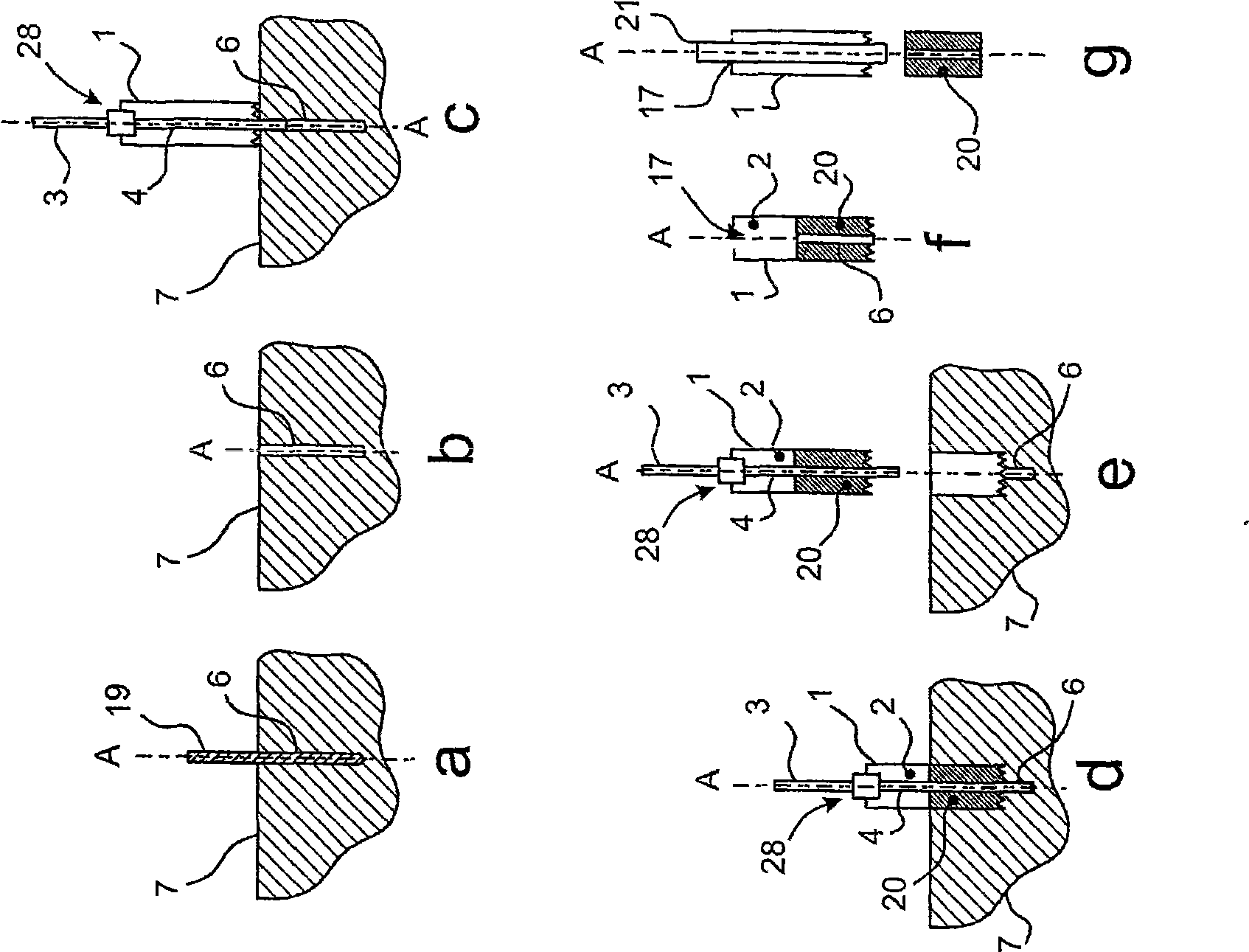 Trephine designed for removal of a bone core and equipped with a device guiding it inside the bone and combining a drill bit and a tubular cutting tool