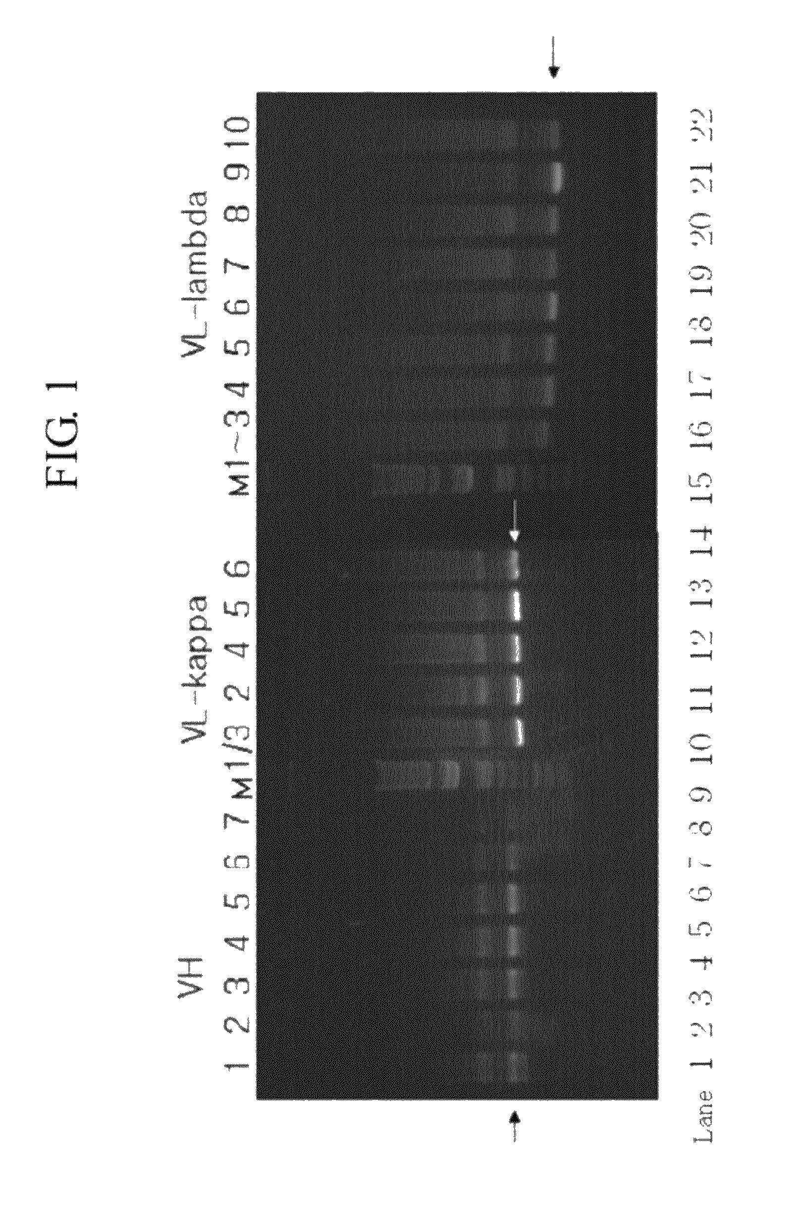 Human antibodies specifically binding to the hepatitis B virus surface antigen