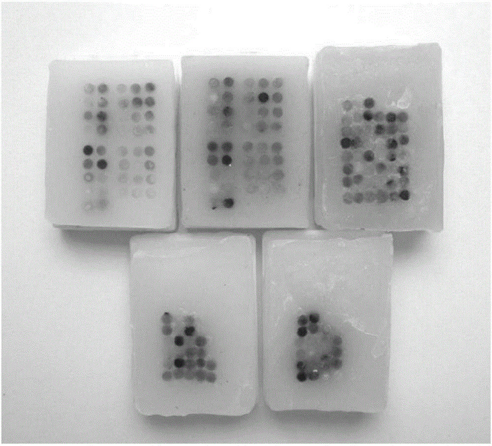 A probe combination and its application for diagnosis of xp11.2 translocation perivascular epithelioid cell tumor