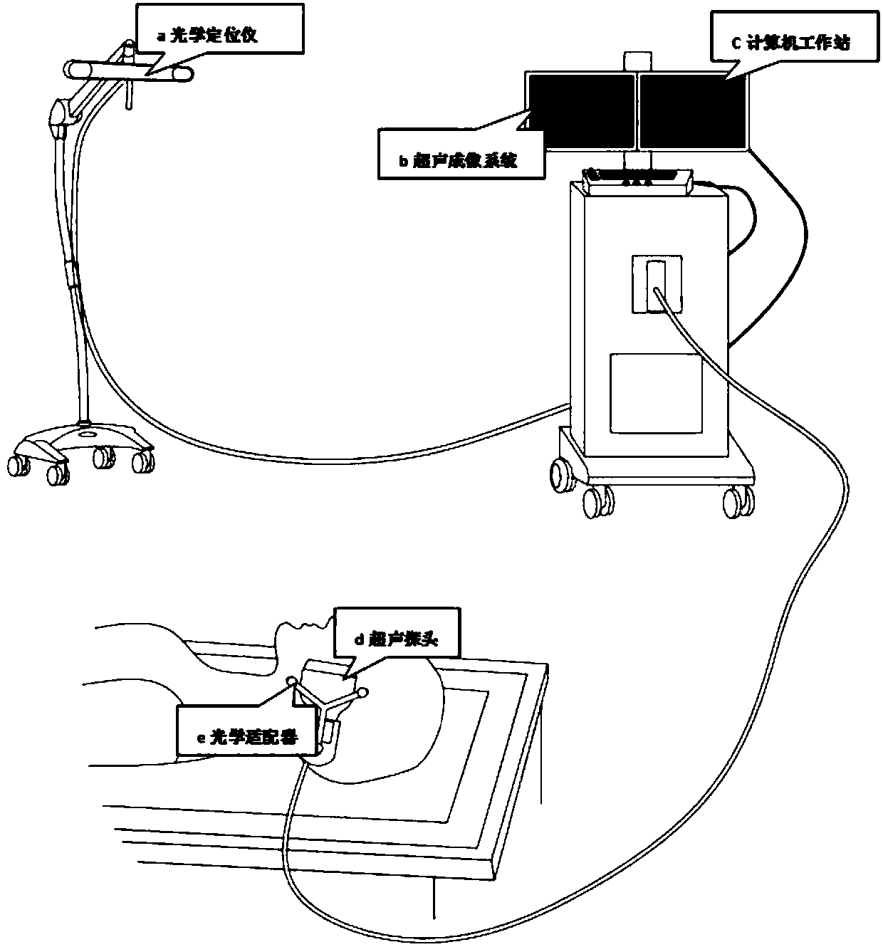 Ultrasonic and CT/MR image fusion surgical navigation system and method based on optical localization rectification