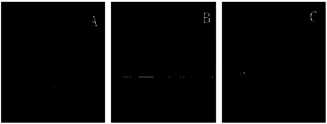 Ultrasonic and CT/MR image fusion surgical navigation system and method based on optical localization rectification