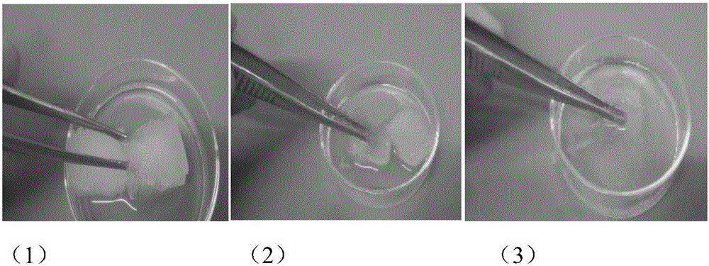 High-expansion degradable nasal cavity filling hemostasis material and preparation method thereof