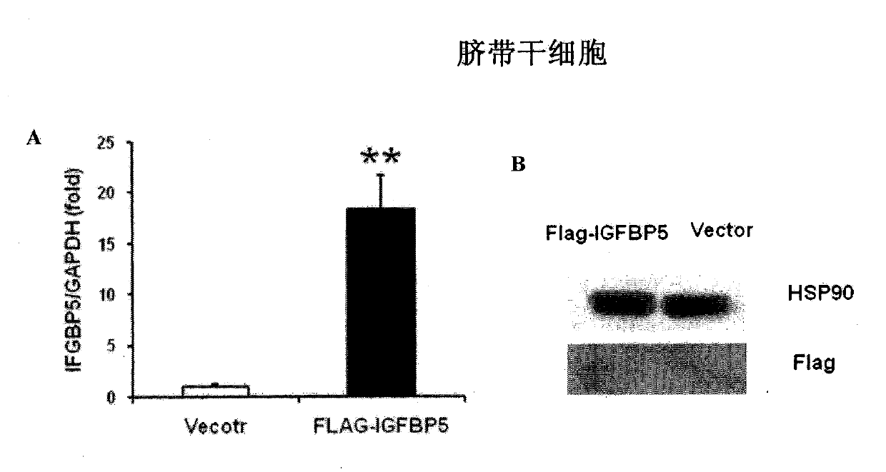 Application of insulin-like growth factor binding protein 5 in promotion of periodontal tissue regeneration