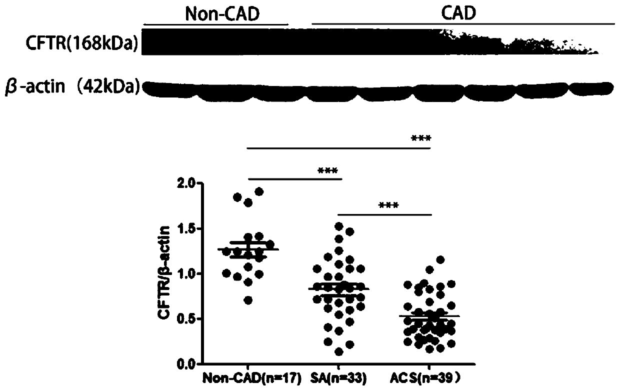 Application of CFTR gene to preparation of thrombotic disease early warning or diagnosing medicine