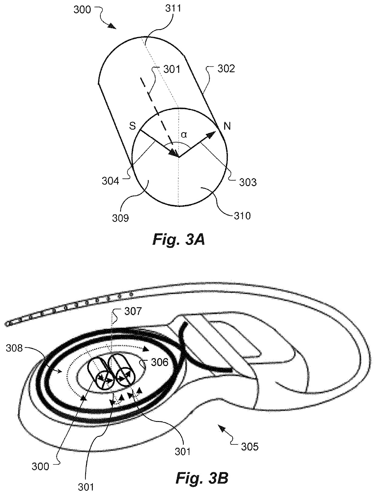 Holding Magnets and Magnet System for Implantable Systems Optimized for MRI