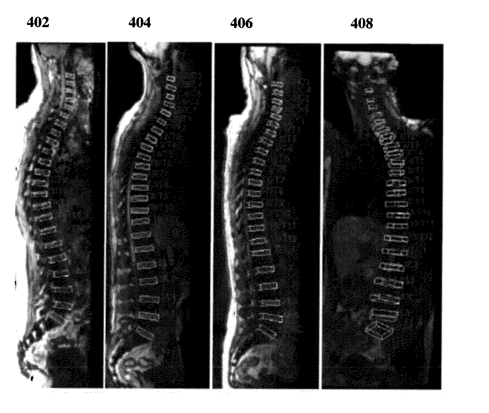 Method and System for Detection 3D Spinal Geometry Using Iterated Marginal Space Learning