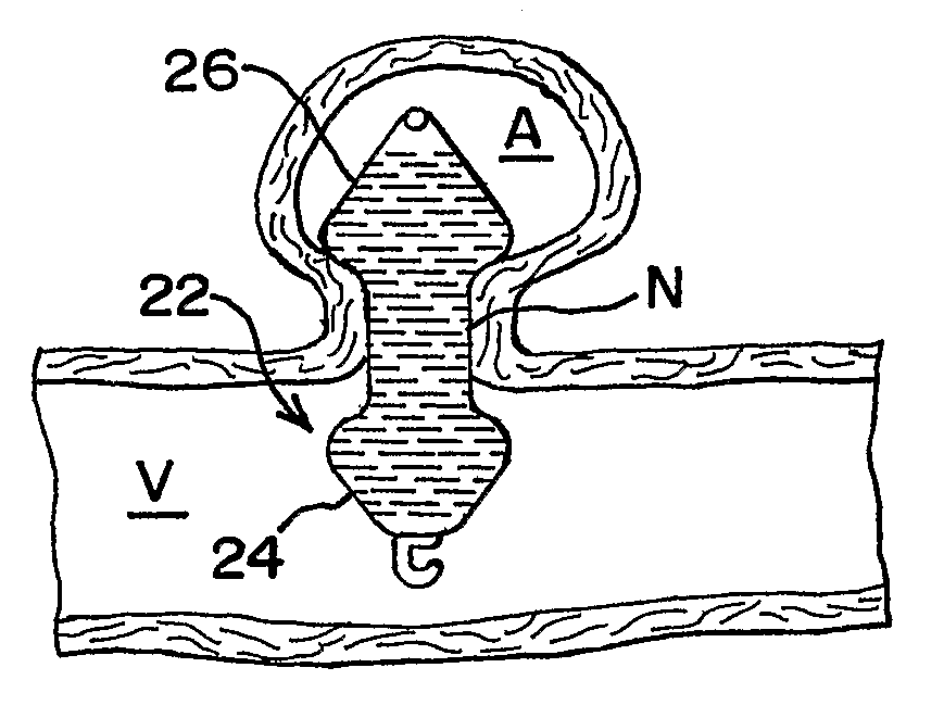 Thin film metallic device for plugging aneurysms or vessels