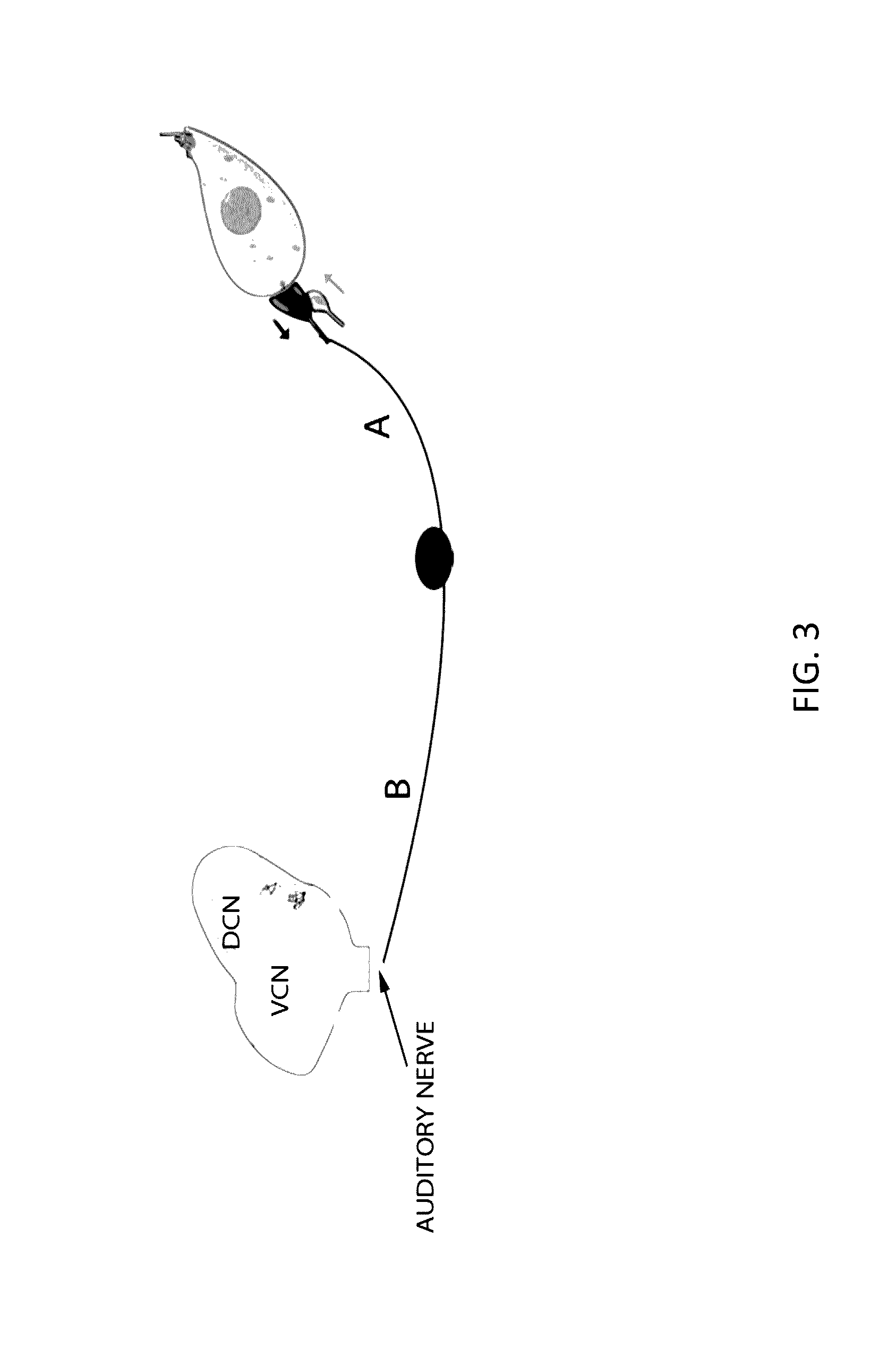 Local cochlear application of statins for stimulating neurite regrowth in the cochlea