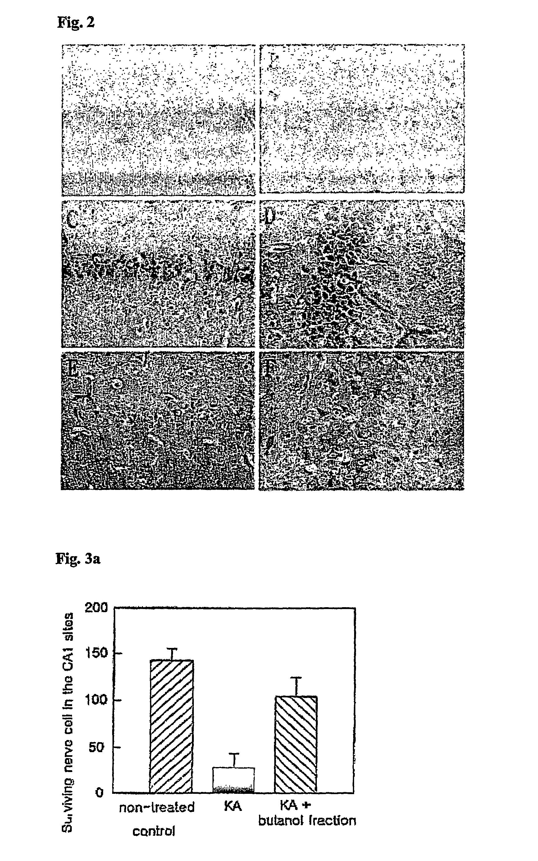 Extract of <i>petasites japonicus </i>having neuroprotective effect and antioxidant activity