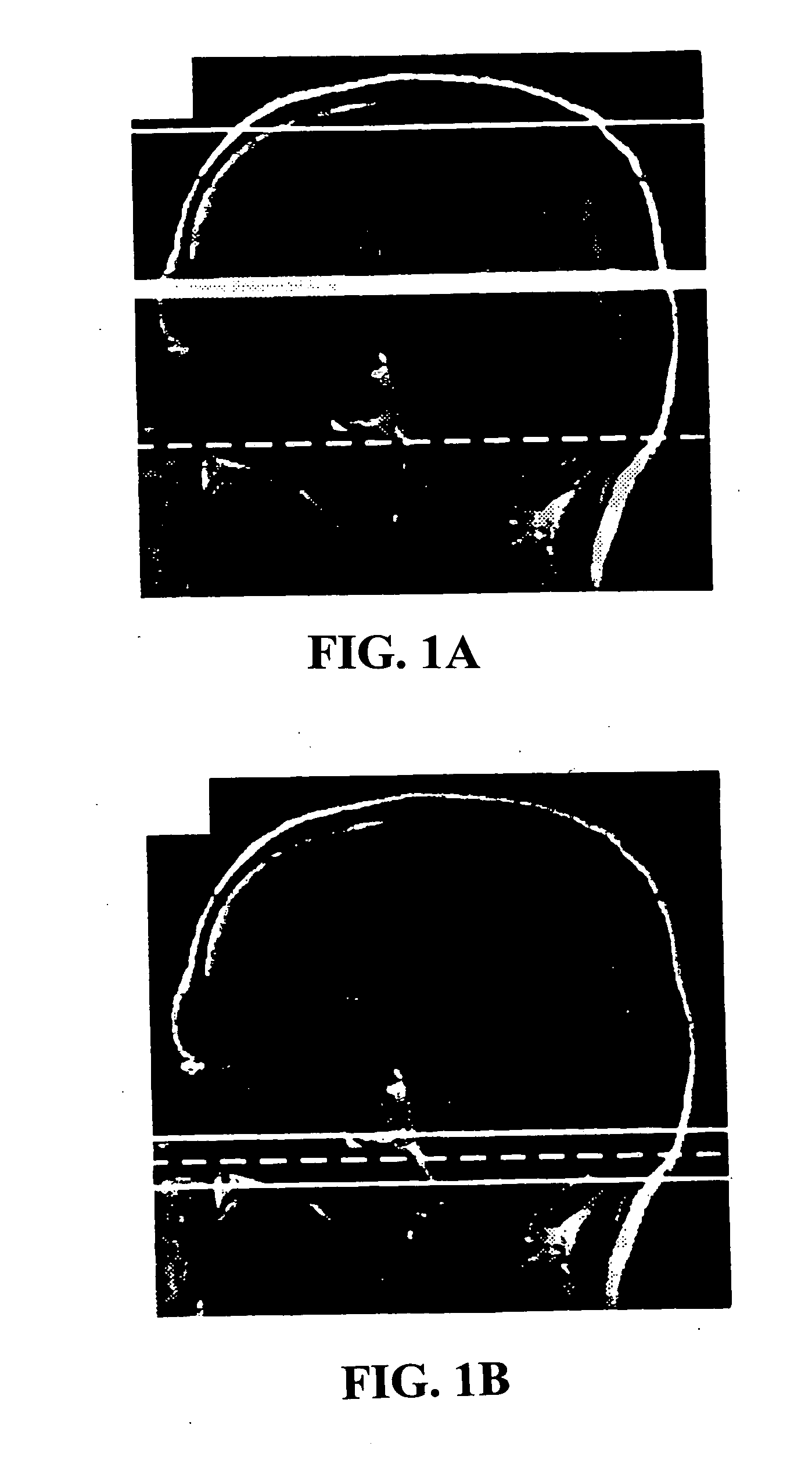 Multi-slice cerebral blood flow imaging with continuous arterial spin labeling MRI