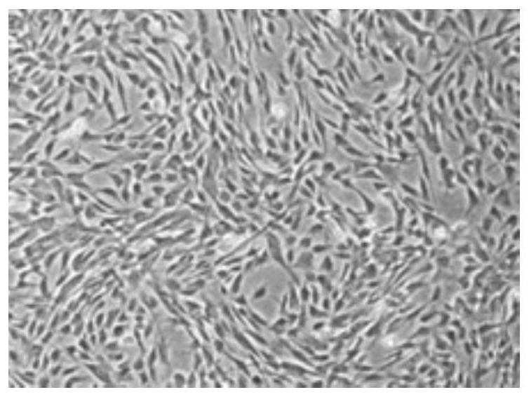 T lymphocyte cryopreservation solution