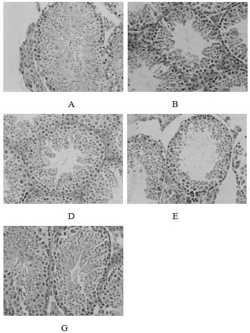 Application of orange leaf extract in preparation of medicine for treating/preventing autoimmune orchitis