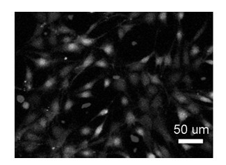 Preparation method of glycopeptide hydrogel containing glucosamine unit and application of glycopeptide hydrogel to preparing postoperation scar inhibitor