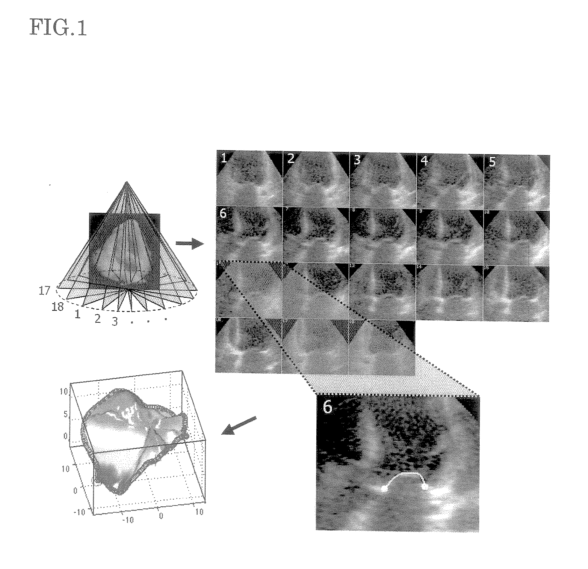 Cardiac Valve Data Measuring Method And Device