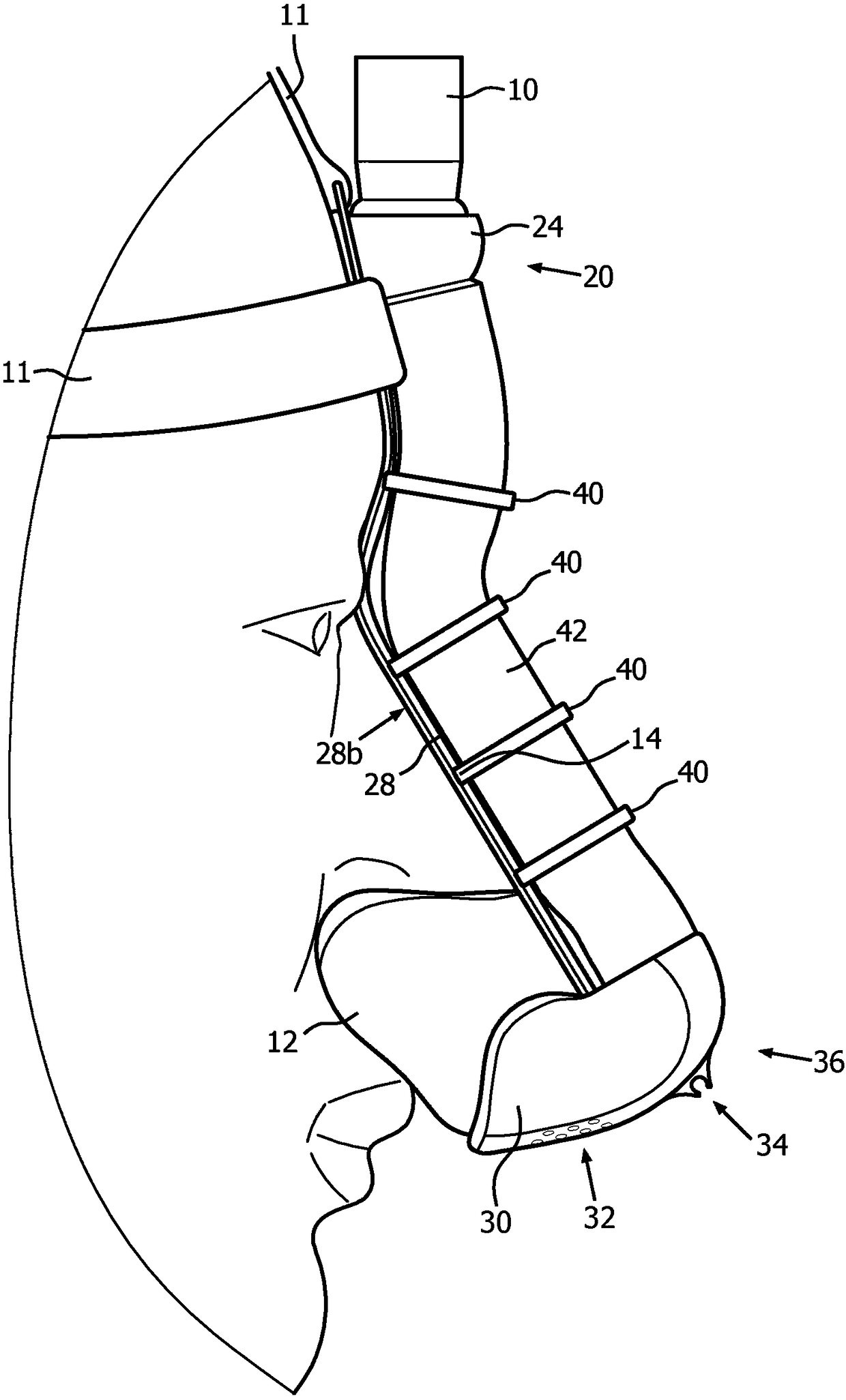 Custom contoured frame for patient interface device