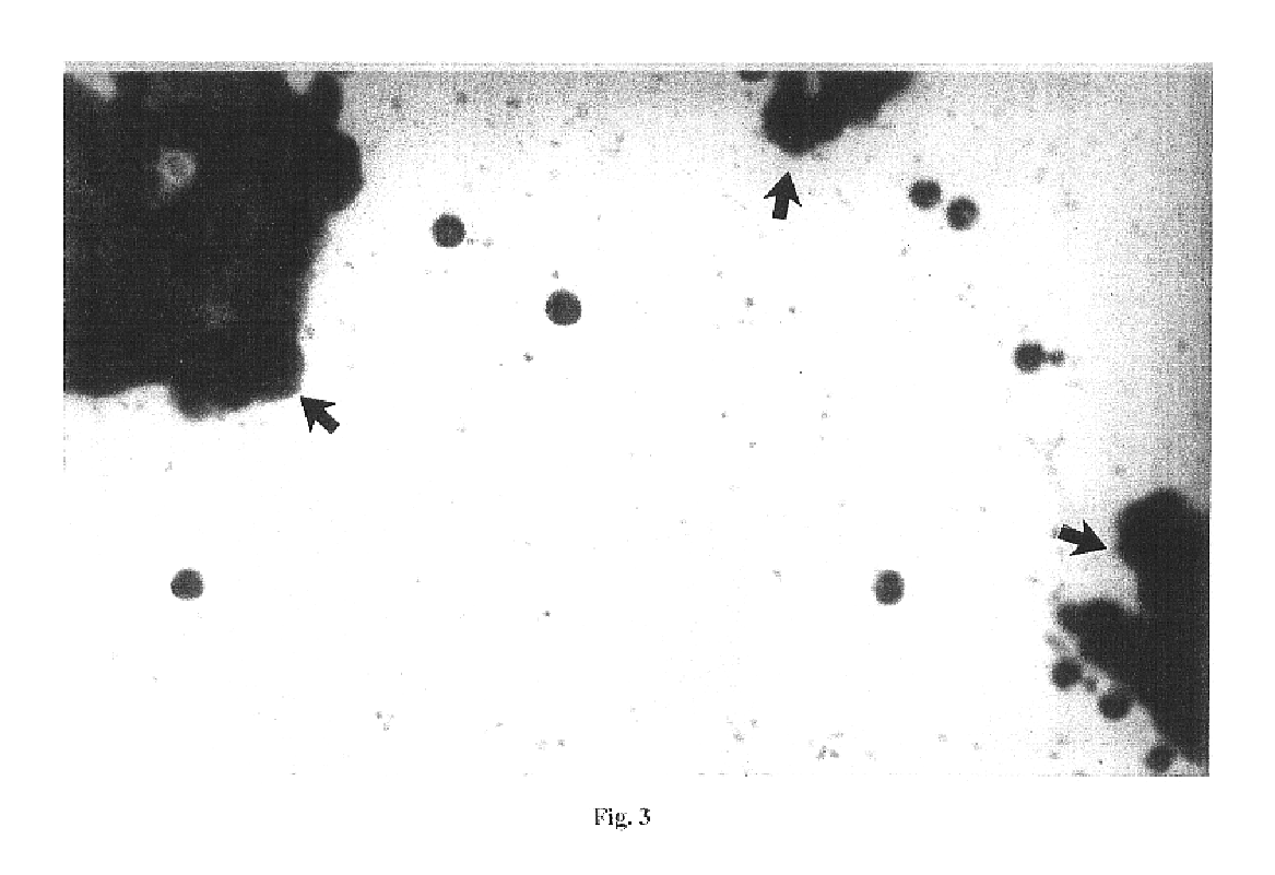 System and method for generating a profile of particulate components of a body fluid sample