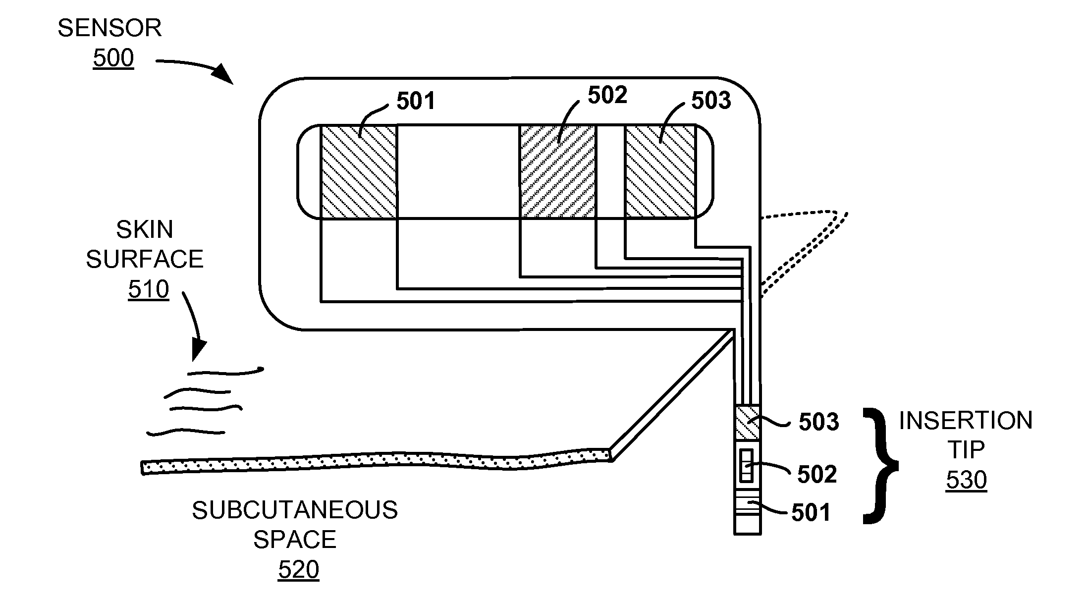 Reference electrodes having an extended lifetime for use in long term amperometric sensors