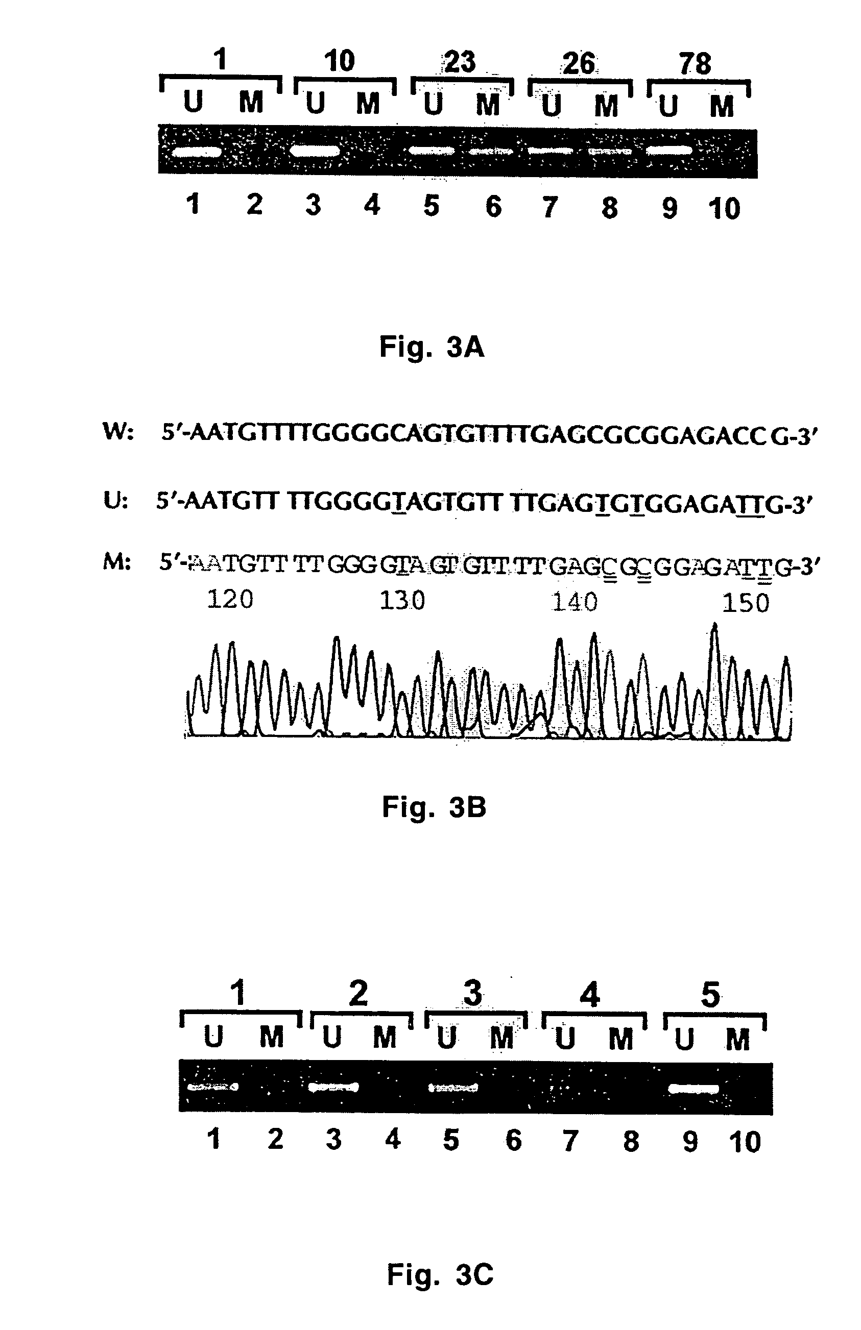 CpG retrieval of DNA from formalin-fixed pathology specimen for promoter methylation analysis