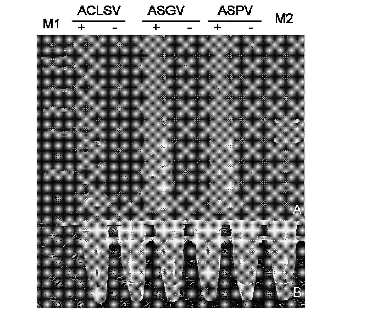 Method for detecting apple viruses by adopting reverse transcription loop-mediated isothermal amplification technology