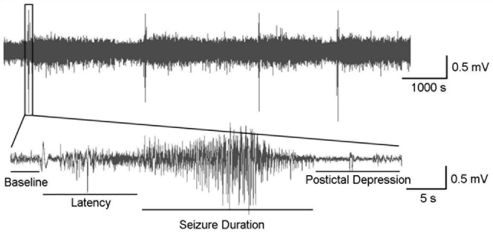 Preparation and application of epilepsy animal model