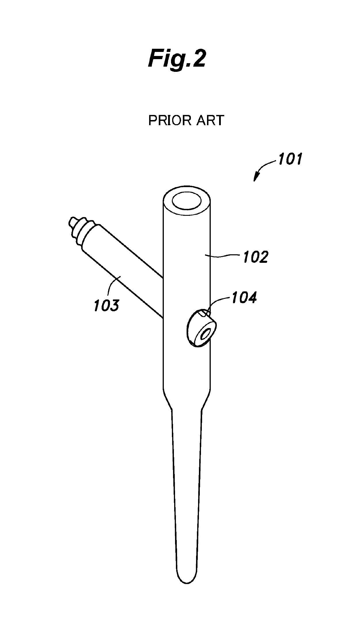 Internal fixator for bone fracture