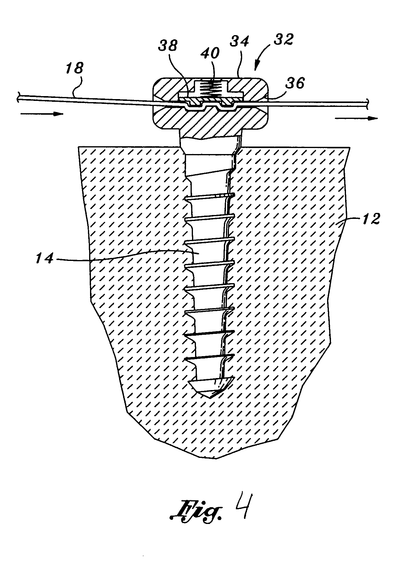 Comprehensive tissue attachment system