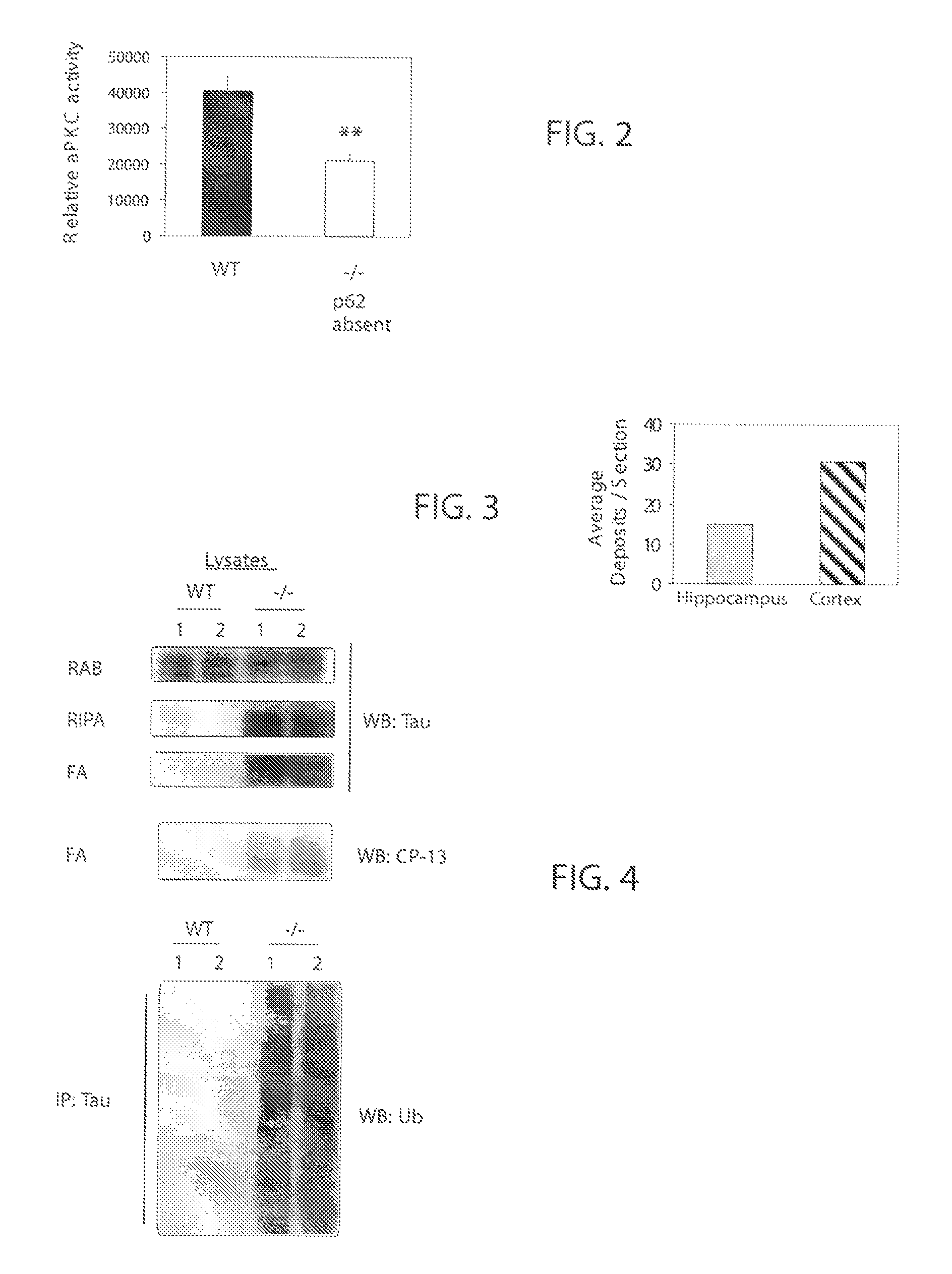 P62 as a diagnostic tool for alzheimer's disease