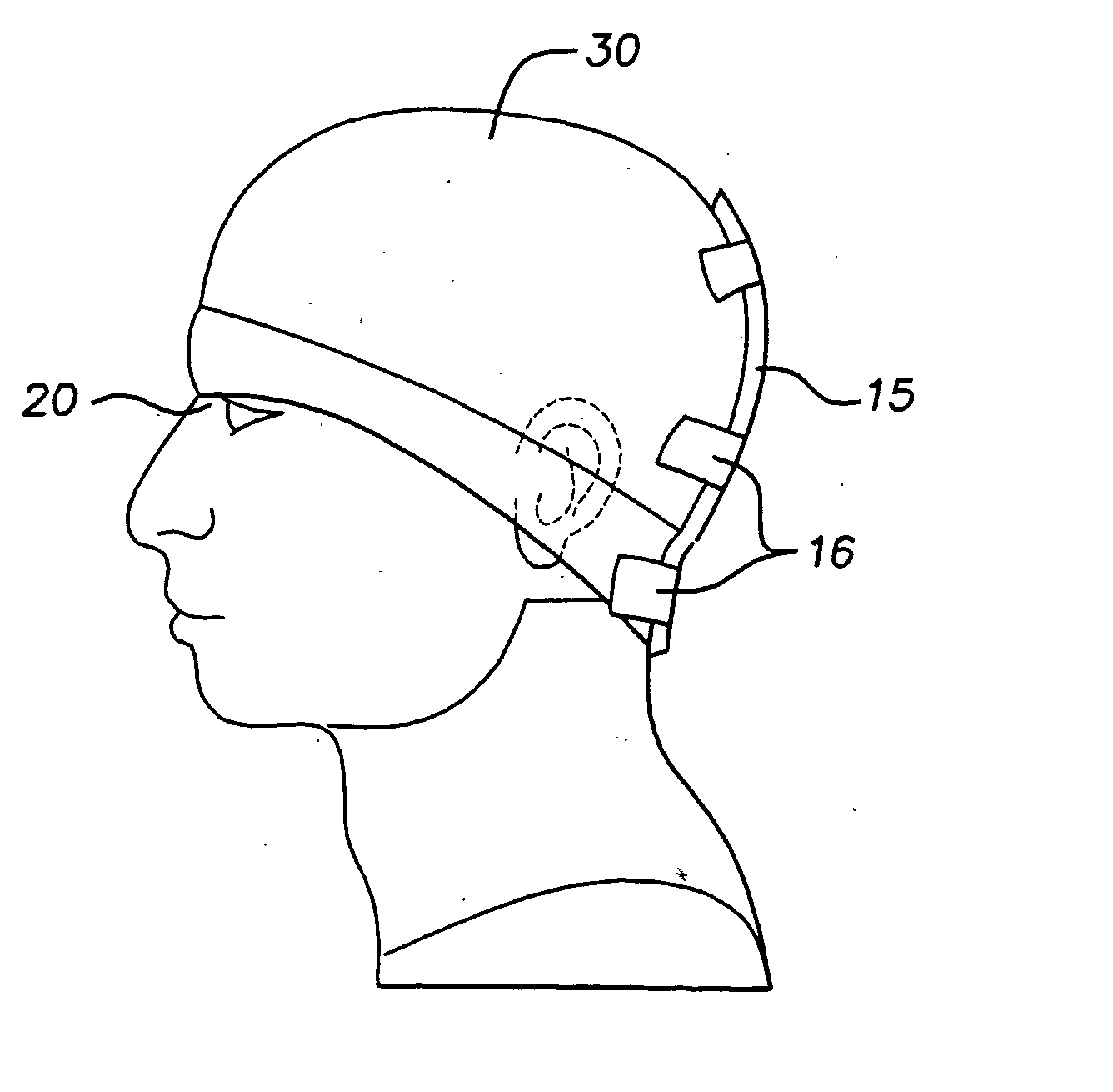 Custom-fitted helmet and method of making the same