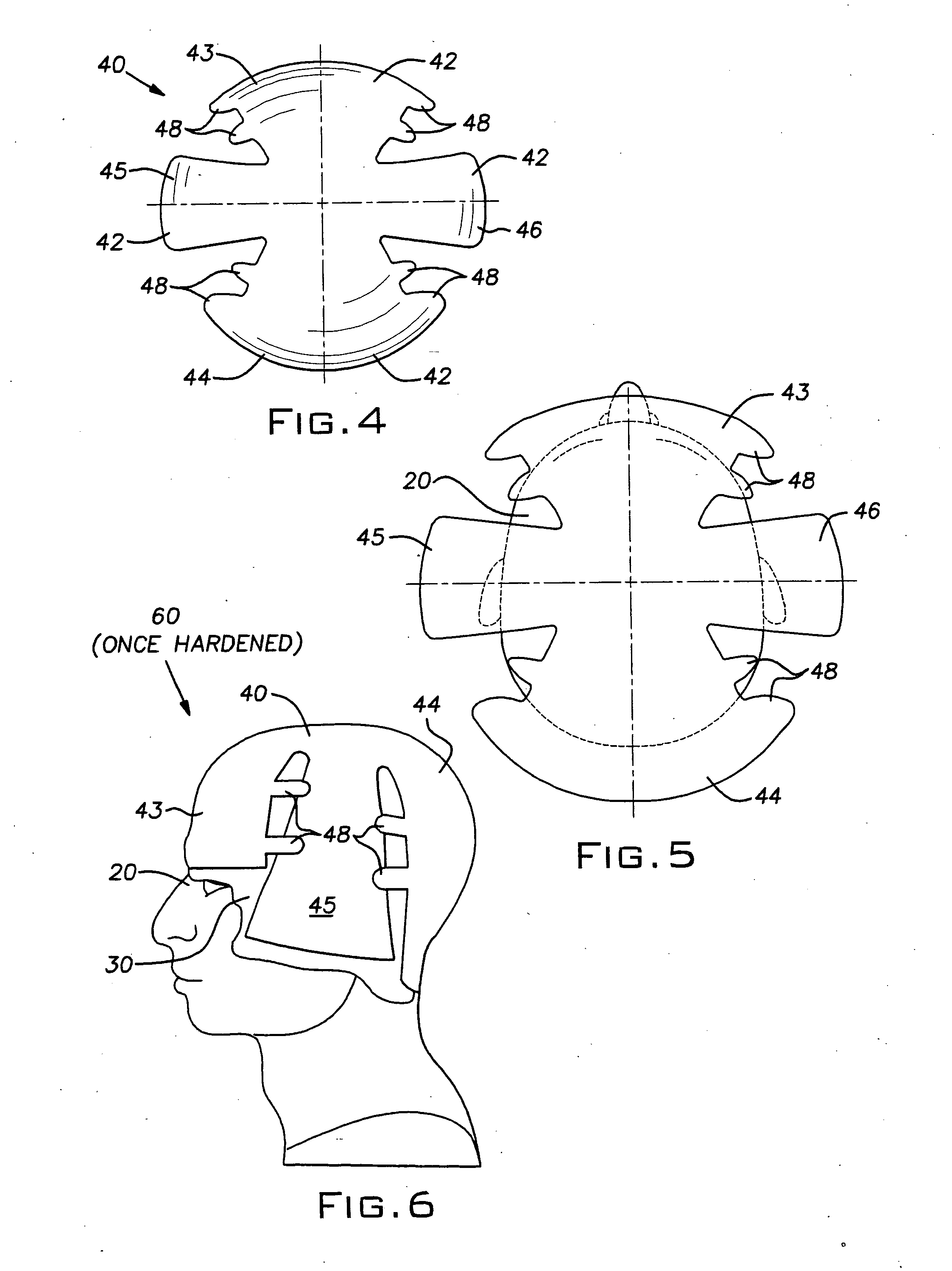 Custom-fitted helmet and method of making the same