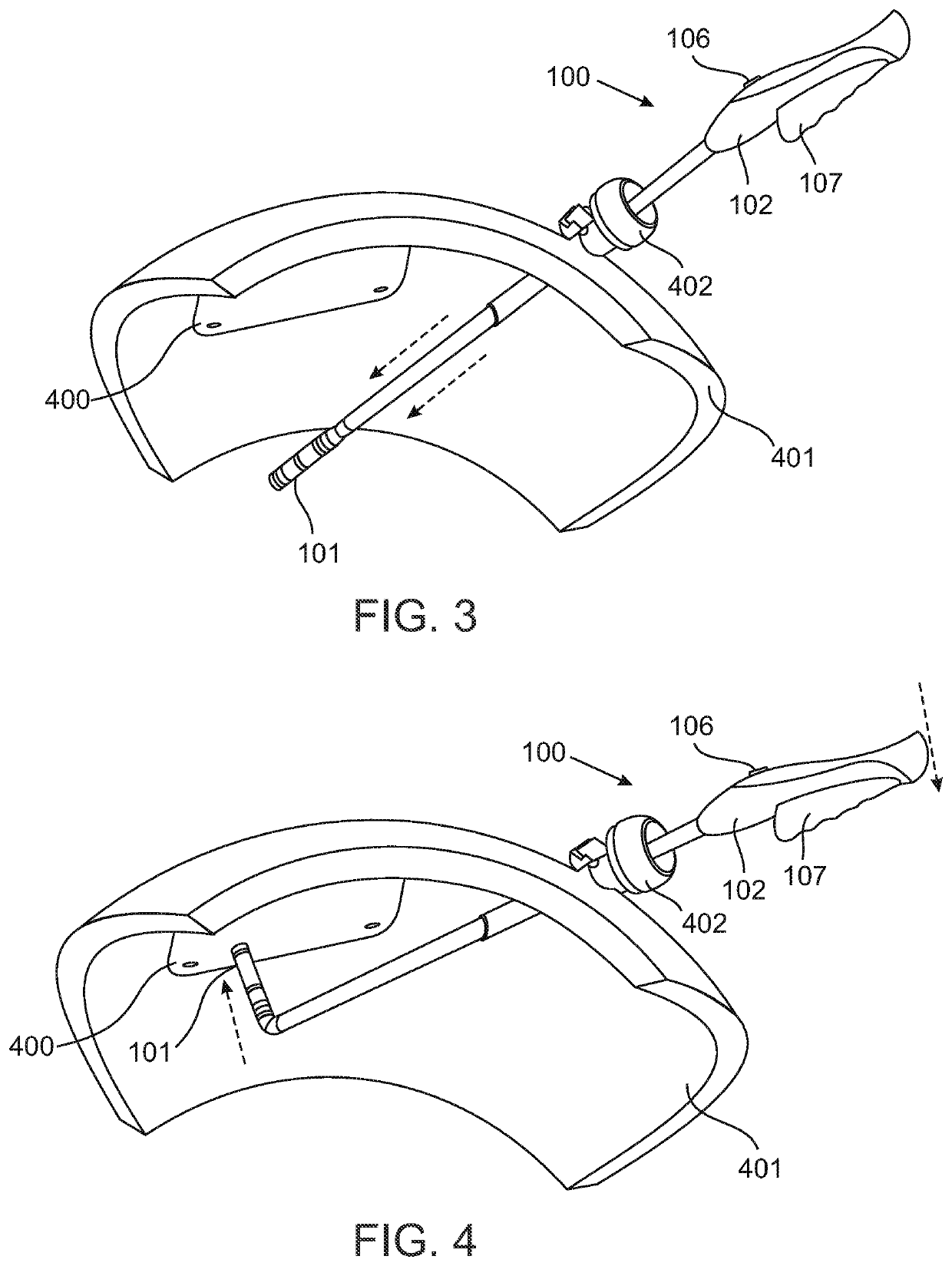 Surgical fastener delivery and locking mechanism