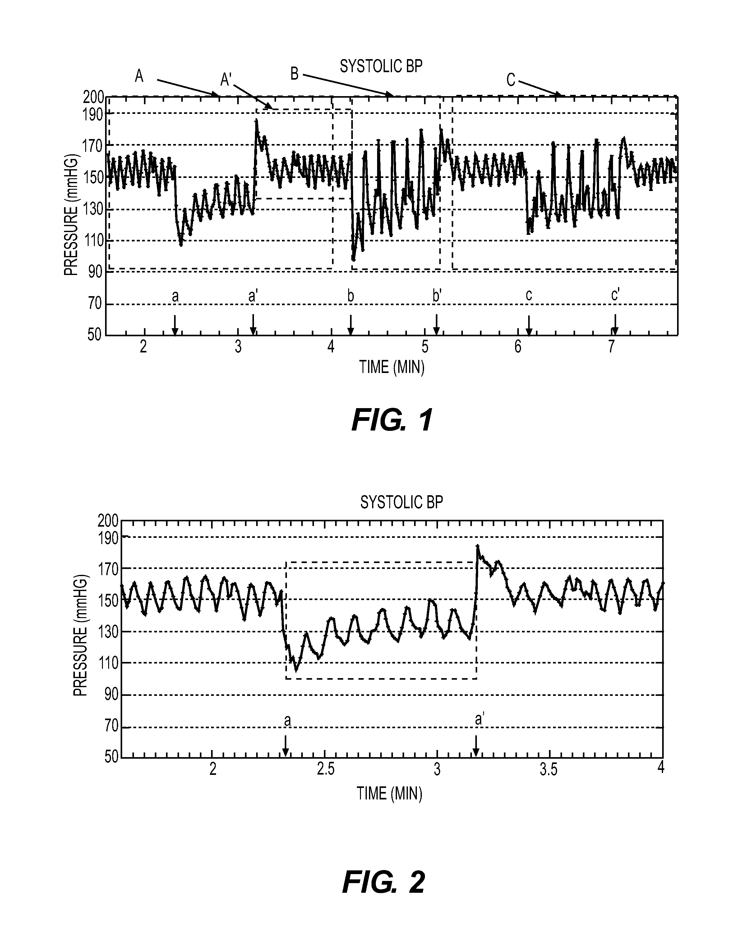 Methods and systems for lowering blood pressure through reduction of ventricle filling