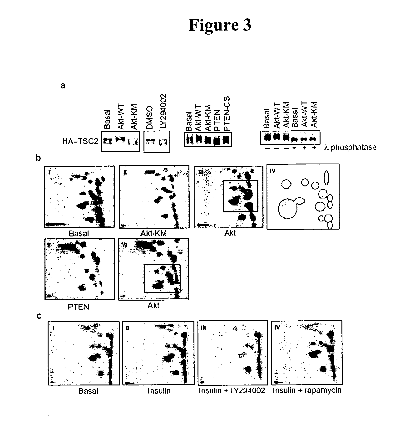 Diagnosis and treatment of diseases arising from defects in the tuberous sclerosis pathway