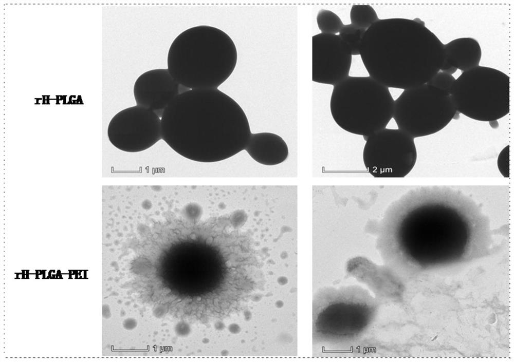 rH-PLGA/PEI microsphere and dopamine modified small-caliber intravascular stent material and preparation method thereof